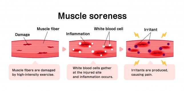 Delayed Onset Muscle Soreness Chart