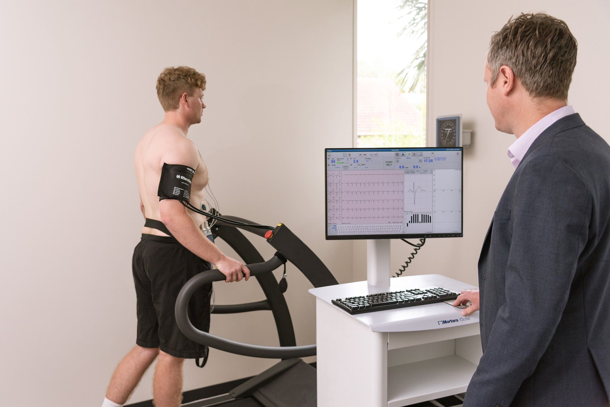 How Long Is A Treadmill Stress Test