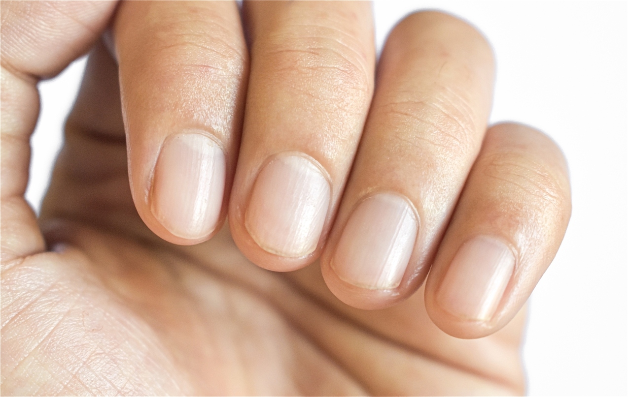 What Do Fingernails Say About Your Health