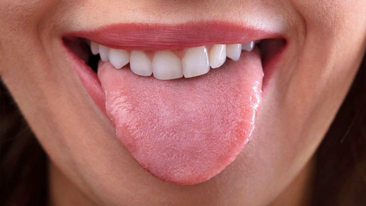 What Does Your Tongue Say About Your Health